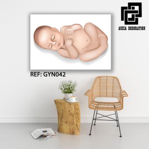 Gynécologie art - GYN042