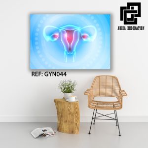 Gynécologie art - GYN044